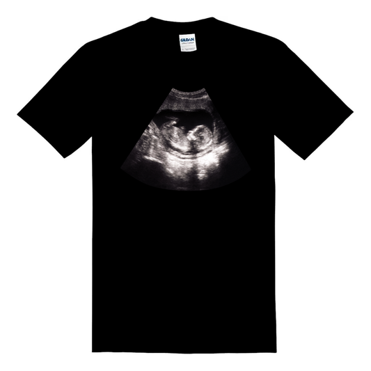 Custom Ultrasound Shirt - Gildan