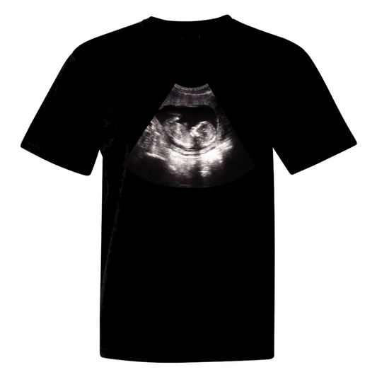 Custom Ultrasound Shirt - Comfort color